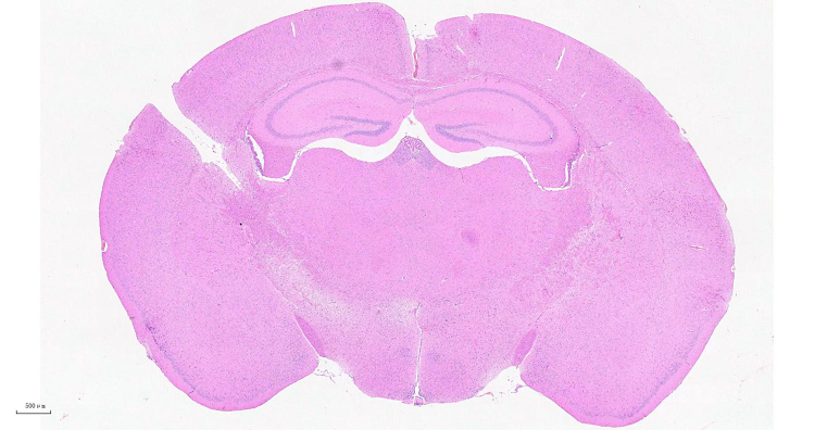 Brain section Brain section