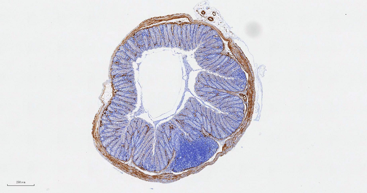 Colon AHorizontal Colon AHorizontal