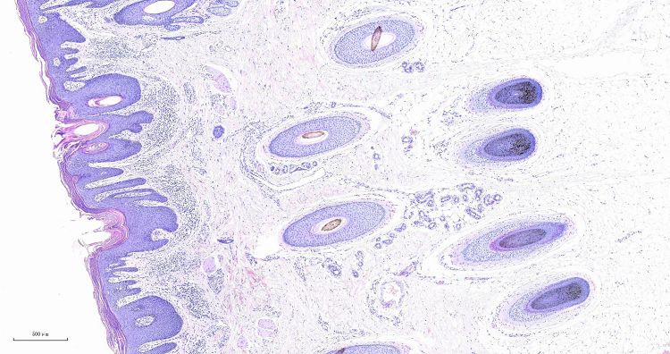 epidermis001 epidermis001