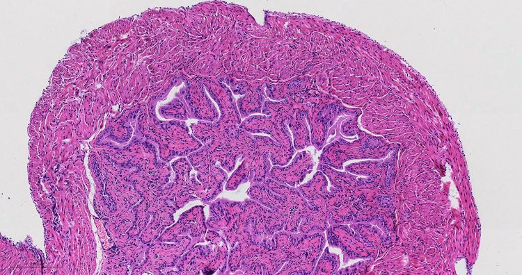 Epididymis001 Epididymis001