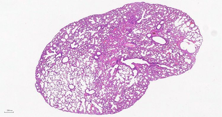 HE Lung tissue001 HE Lung tissue001