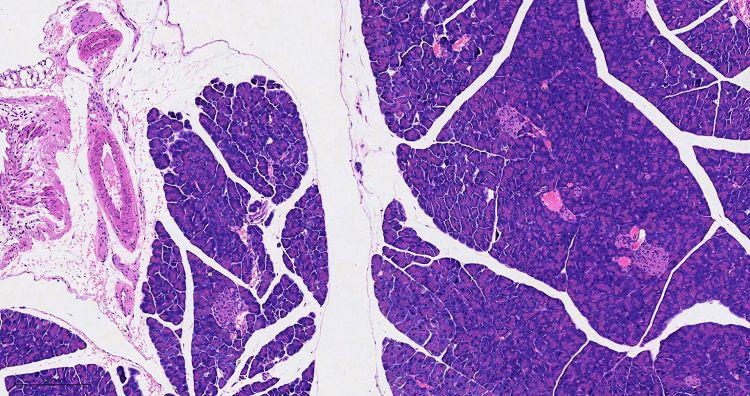 Pancreas001 Pancreas001