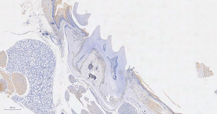 tooth stained with IHC001 tooth stained with IHC001